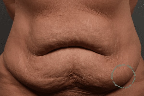 mommy make over fotos