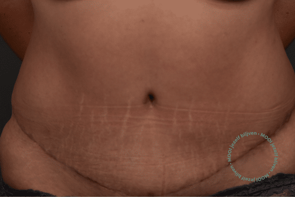 mommy make over resultaat