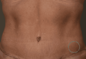 mommy make over resultaat