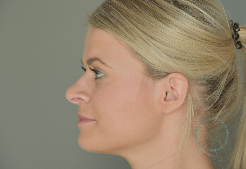 neuscorrectie voor foto