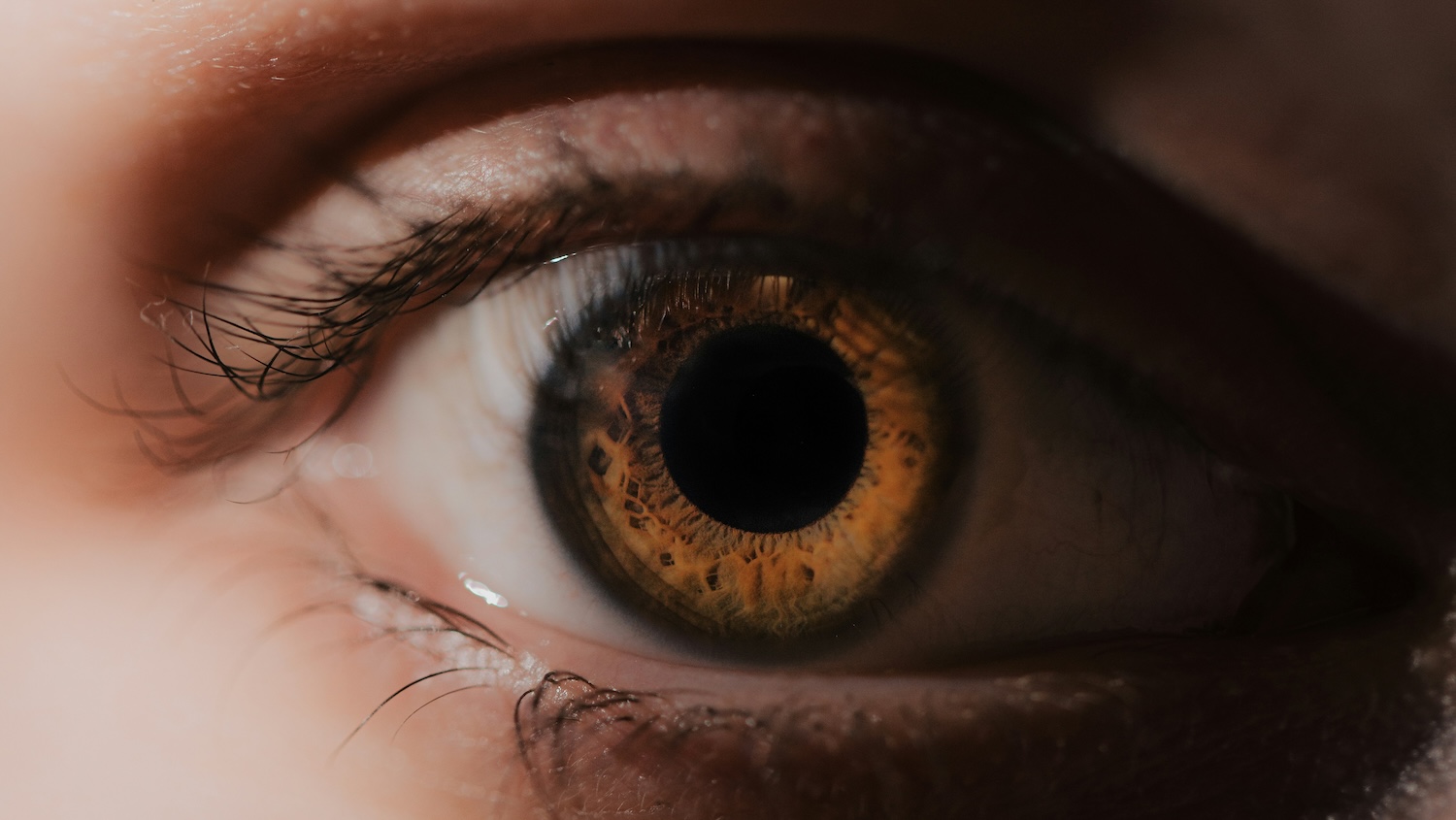 blepahritis na een ooglidcorrectie