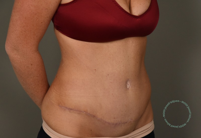 mommy make over buik