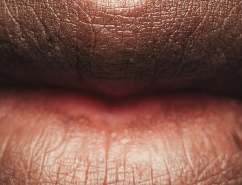 Lipflip: Subtiele lipverandering