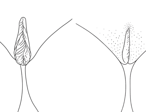 Schaamlippen verkleinen ervaring: Schaamlipcorrectie bij MOOI kliniek